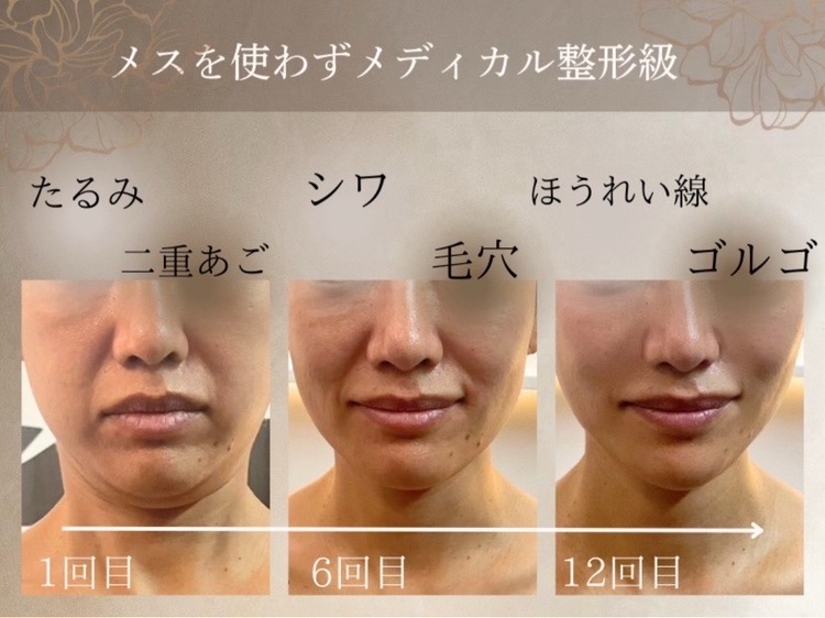 1回目→6回目→12回目の変化