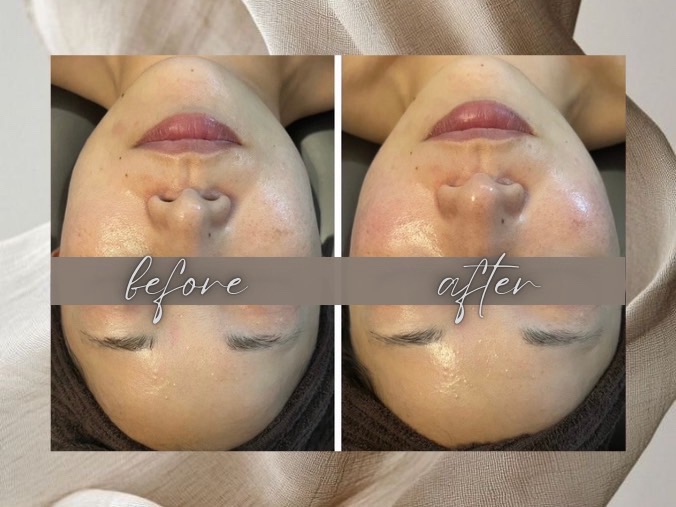 Before After 06
