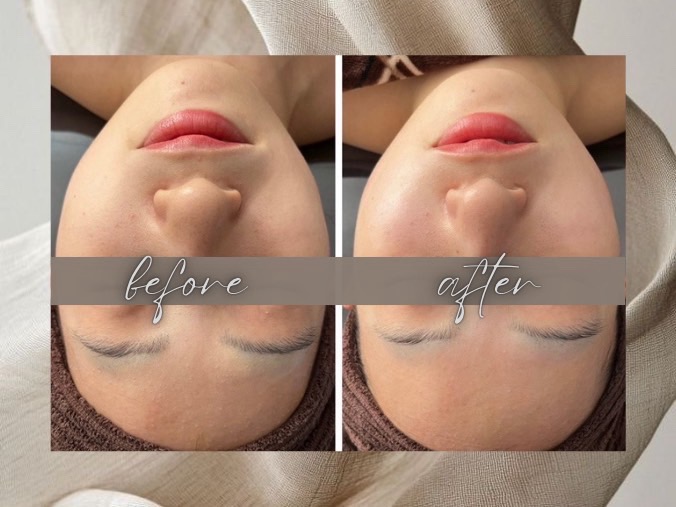 Before After 07